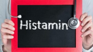 hisztamin intolerancia